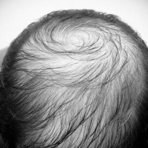 istockphoto-1284533217-612×612 istockphoto-1284533217-612x612