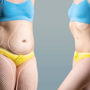waist-sculpting-3 waist-sculpting-3