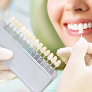 teeth-whitening-riyadh-17