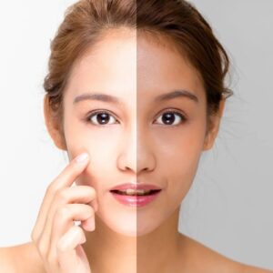 skin-whitening-cream