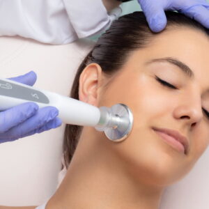 laser-treatment-for-face-in-dubai-price-3 laser-treatment-for-face-in-dubai-price-3