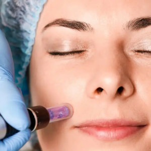 microneedling-banner-jpg microneedling-banner-jpg