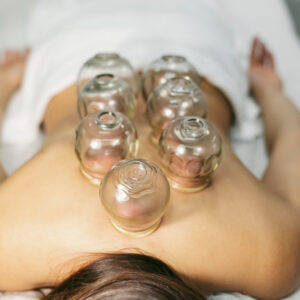 the-benefits-of-hijama-cupping-therapy