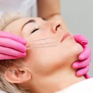 thread_lift_image-1024x683