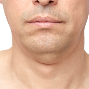 double_20chin_20chin_20fat double_20chin_20chin_20fat