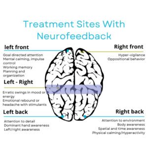 treatment-sites-with-neurofeedback-adhd-image treatment-sites-with-neurofeedback-adhd-image